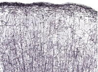 Oligodendrocytes