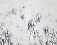 Oligodendrocytes
