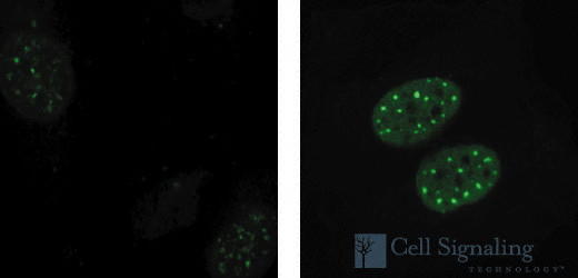 Chk1,2, phosphorylated BioAssay™ Sample Kit |