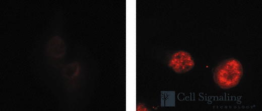 Chk1,2, phosphorylated BioAssay™ Sample Kit |