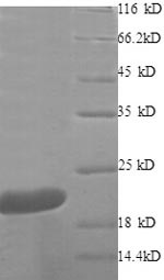 TNF, Recombinant, Human, aa77-233, His-Tag