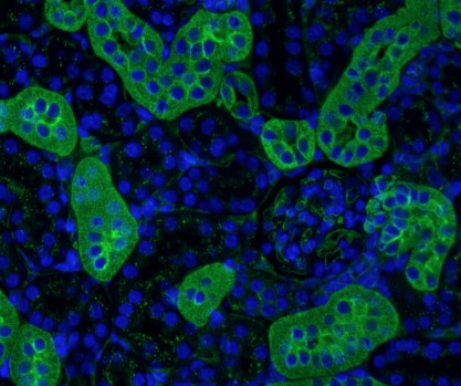 Lycopersicon Esculentum Lectin
