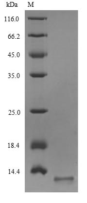M2, Recombinant, Influenza A Virus, aa1-22, His-Tag