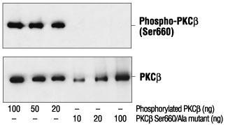 Protein Kinase C, phosphorylated