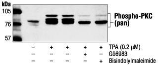Protein Kinase C, phosphorylated