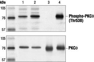 Protein Kinase C, phosphorylated