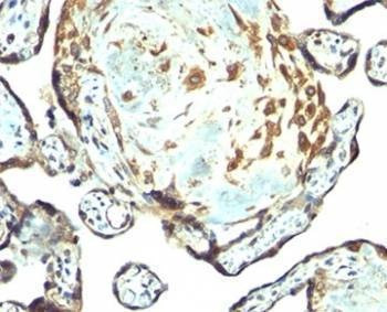 Anti-TIMP3 Antibody, Sodium Azide Free