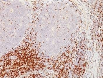 Anti-CD5 Antibody, Sodium Azide Free