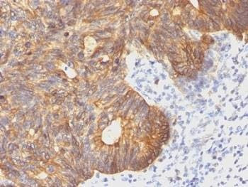 Anti-Cytokeratin 8 Antibody, Sodium Azide Free