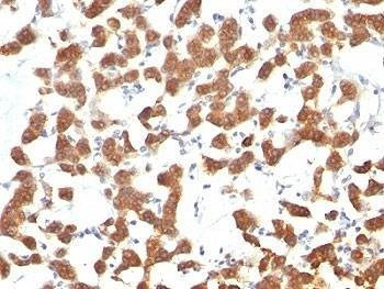 Anti-Keratin 18 Antibody, Sodium Azide Free