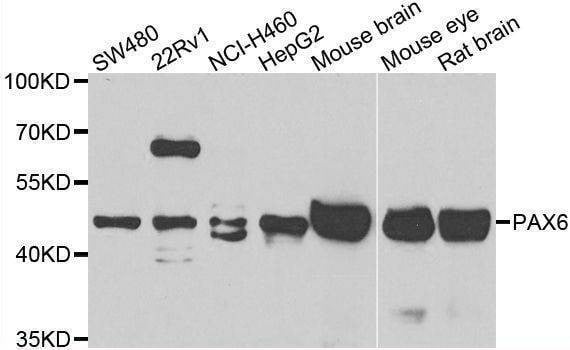 Anti-PAX6 Antibody