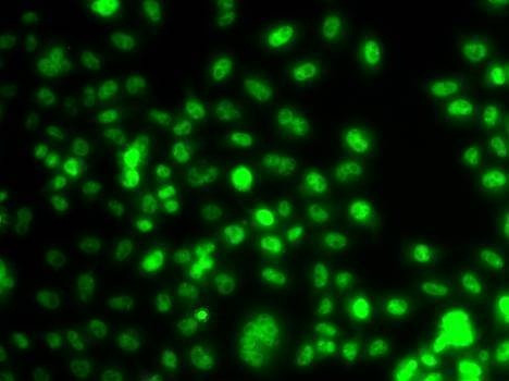 Anti-PAX6 Antibody