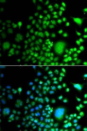 Anti-PAX6 Antibody