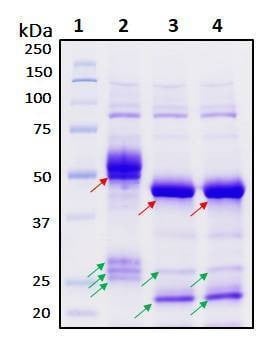 Recombinant SARS-CoV-2 Nucleocapsid Protein