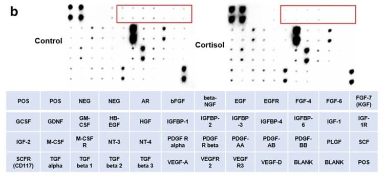 Figure adapted from Choi et al., Molecular Psychiatry, 2023.