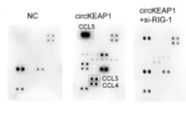 Figure adapted from Zhang et al., Journal of Experimental & Clinical Cancer Research, 2024.