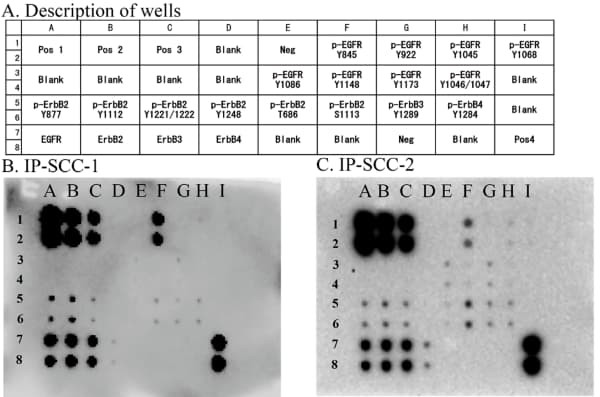 RayBiotech's EGFR Phosphorylation Antibody Array revealed key EGFR phosphorylation sites in carcinoma arising from inverted papilloma. Figure adapted from Hirakawa et al., Journal of Personalized Medicine, 2023.
