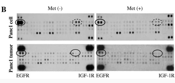 RayBiotech's EGFR Phosphorylation Antibody Array revealed reduced EGFR-Y845 phosphorylation in pancreatic cancer cells and tumors treated with metformin. Figure adapted from Kato et al., Oncology Reports, 2016.