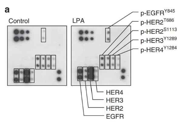 RayBiotech's EGFR Phosphorylation Antibody Array revealed SRC-mediated phosphorylation of EGFR-Y845 in ovarian cancer cells stimulated with lysophosphatidic acid. Figure adapted from Panupinthu et al., Oncogene, 2013.