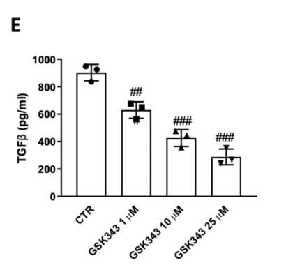 ELH-TGFb1 was used to measure TGF-β1 levels in conditioned media from oral squamous cell carcinoma cells following EZH2 inhibition. Figure adapted from Campolo et al., Pharmaceuticals (Basel), 2024.