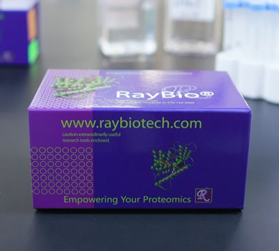 Lipid Peroxidation (MDA) Assay Kit