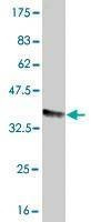 Anti-FCGR2A Antibody