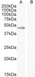 STJ72337 (0. 1µg/ml) staining of K56 cell lysate (A) + peptide (B) (35µg protein in RIPA buffer). Detected by chemiluminescence.