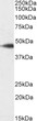 Biotinylated STJ725<style>.product-options .custom-field{display:inline-block;background:#aaa;}</style><style>.label-data{font-weight:bold;min-width:100px;}.label-data,.data{display:inline-block;min-width:100px;}.description table{word-break:break-all;}.description table td{min-width:200px;}</style></div></div></div>
				      </div>
                      </div>
  </div>

    </div>




<div class=