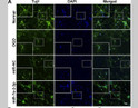 Zhang, Zi-Bin, et al. "miRNA-7a-2-3p Inhibits Neuronal Apoptosis in Oxygen-Glucose Deprivation (OGD) Model. " Frontiers in neuroscience 13 (2019).