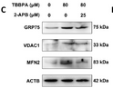 Polysaccharides from Tetrastigma Hemsleyanum Diels et Gilg ameliorated inflammatory bowel disease by rebuilding the intestinal mucosal<style>.product-options .custom-field{display:inline-block;background:#aaa;}</style><style>.label-data{font-weight:bold;min-width:100px;}.label-data,.data{display:inline-block;min-width:100px;}.description table{word-break:break-all;}.description table td{min-width:200px;}</style></div></div></div>
				      </div>
                      </div>
  </div>

    </div>




<div class=