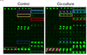 Exosomes secreted from cardiomyocytes suppress the sensitivity of tumor ferroptosis in ischemic heart failure Signal Transduction and Targeted Therapy Baofeng Yang WB mouse plasma LLC cell, K7M2 cell