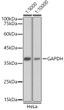 Western blot analysis of extracts of HeLa cells, using GAPDH antibody as the primary antibody. Secondary antibody: HRP Goat Anti-mouse IgG (H+L) antibody (STJS000854) at 1:5000/1:10000 dilution. Lysates/proteins: 25 Mu g per lane. Blocking buffer: 3% non-fat dry mil<style>.product-options .custom-field{display:inline-block;background:#aaa;}</style><style>.label-data{font-weight:bold;min-width:100px;}.label-data,.data{display:inline-block;min-width:100px;}.description table{word-break:break-all;}.description table td{min-width:200px;}</style></div></div></div>
				      </div>
                      </div>
  </div>

    </div>



<script>
			var searchid = 