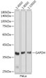 Western blot analysis of extracts of HeLa cells, using GAPDH (STJ11103681) antibody as the primary antibody at dilution of 1:80000. Secondary antibody: using HRP Goat Anti-rabbit IgG (H+L) antibody (STJS000856) at 1:4000-1:10000 dilution. Lysates/pro<style>.product-options .custom-field{display:inline-block;background:#aaa;}</style><style>.label-data{font-weight:bold;min-width:100px;}.label-data,.data{display:inline-block;min-width:100px;}.description table{word-break:break-all;}.description table td{min-width:200px;}</style></div></div></div>
				      </div>
                      </div>
  </div>

    </div>



<script>
			var searchid = 
