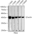 Western blot analysis of lysates from HeLa cells, using Beta-actin antibody as the primary antibody. <br/>Secondary antibody: HRP Donkey Anti-Rabbit IgG (H+L) antibody (STJS001185) at 1:2000-1:30000 dilution<br/>Lysates/proteins: 25 Mu g per lane. <br/>Bloc<style>.product-options .custom-field{display:inline-block;background:#aaa;}</style><style>.label-data{font-weight:bold;min-width:100px;}.label-data,.data{display:inline-block;min-width:100px;}.description table{word-break:break-all;}.description table td{min-width:200px;}</style></div></div></div>
				      </div>
                      </div>
  </div>

    </div>




<div class=