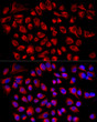 Confocal imaging of HeLa cells using [KD Validated] TIMM10 Rabbit mAb (STJ248506, dilution 1:200) followed by a further incubation with ABflo® 594-conjugated Goat Anti-Rabbit IgG (H+L) (STJS001186, dilution 1:400). DAPI was used for nuclear staining (Blue). Objective: 100x.