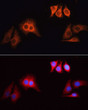 Immunofluorescence analysis of HeLa cells, using Rhodamine (TRITC) Goat Anti-Rabbit IgG (H+L) (STJ22487) as the primary antibody at dilution of 1:100. The cells were incubated with the primary antibody overnight at 4°C. <br/>Secondary antibody: Rhodamine (TRITC) Goat Anti-Rabbit IgG (H+L<style>.product-options .custom-field{display:inline-block;background:#aaa;}</style><style>.label-data{font-weight:bold;min-width:100px;}.label-data,.data{display:inline-block;min-width:100px;}.description table{word-break:break-all;}.description table td{min-width:200px;}</style></div></div></div>
				      </div>
                      </div>
  </div>

    </div>




<div class=