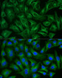 Immunofluorescence analysis of HeLa cells using Alpha-tubulin (ubiquitous) chain Rabbit mAb (STJ11103694) (40x lens) , the secondary antibody was ABflo® 488-conjugated AffiniPure Goat Anti antibody (STJS001206) used at dilution of 1 : 200. Secondary antibody: Cy3-conjugated Goat <style>.product-options .custom-field{display:inline-block;background:#aaa;}</style><style>.label-data{font-weight:bold;min-width:100px;}.label-data,.data{display:inline-block;min-width:100px;}.description table{word-break:break-all;}.description table td{min-width:200px;}</style></div></div></div>
				      </div>
                      </div>
  </div>

    </div>




<div class=