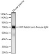 Western blot analysis of lysates from Mouse IgM using HRP Rabbit anti-Mouse IgM mAb (STJS001217) at 1:50000 dilution. <br/>Lysates/proteins: 50ng per lane. <b<style>.product-options .custom-field{display:inline-block;background:#aaa;}</style><style>.label-data{font-weight:bold;min-width:100px;}.label-data,.data{display:inline-block;min-width:100px;}.description table{word-break:break-all;}.description table td{min-width:200px;}</style></div></div></div>
				      </div>
                      </div>
  </div>

    </div>




<div class=