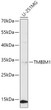 Western blot analysis of lysates from U-251MG cells, using TMBIM1 Rabbit pAb (STJ11107508) at 1:1000 dilution. <br/>Secondary antibody: HRP-conjugated Goat anti-Rabbit IgG (H+L) (STJS000856) at 1:10000 dilution. <br/>Lysates/proteins: 25 Mu g per lane. <br/>Blocking buffer: 3% nonfat dry milk in TBST. <br/>Detection: ECL Basic Kit <br/>Exposure time: 3min.