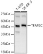 Western blot analysis of various lysates using TFAP2C Rabbit polyclonal antibody (STJ110050) at 1:1000 dilution. Secondary antibody:HRP Goat Anti-Rabbit IgG (H+L) (STJS000856) at 1:10000 dilution. Lysates/ proteins: 25 Mu g per lane. Blocking buffer: 3 % nonfat dry milk in TBST. Detection:ECL Basic Kit. Exposuretime: 60s.