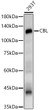 Western blot analysis of 293T, using CBL antibody (STJ22913) at 1:3000 dilution. Secondary antibody: HRP Goat Anti-rabbit IgG (H+L) (STJS000856) at 1:10000 dilution. Lysates/proteins: 25 Mu g per lane. Blocking buffer: 3% non-fat dry milk in TBST. Detection: ECL Basic Kit. Exposure time: 30s.