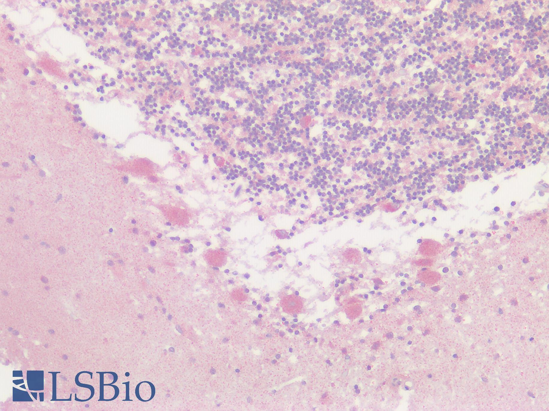 GPRC5D Antibody - Human Brain, Cerebellum: Formalin-Fixed, Paraffin-Embedded (FFPE)
