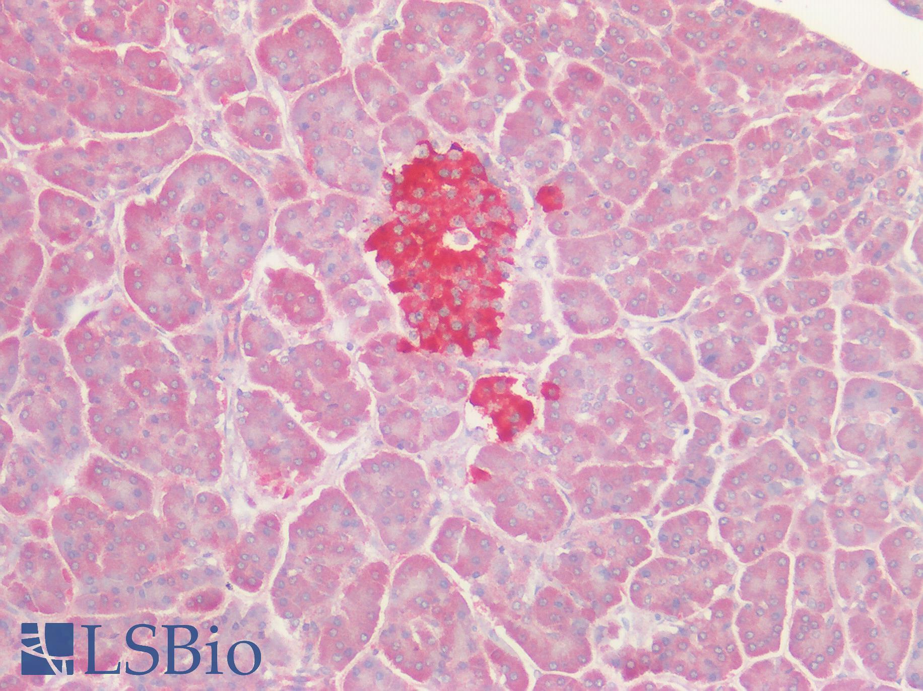 GPRC5D Antibody - Human Pancreas, Islets: Formalin-Fixed, Paraffin-Embedded (FFPE)