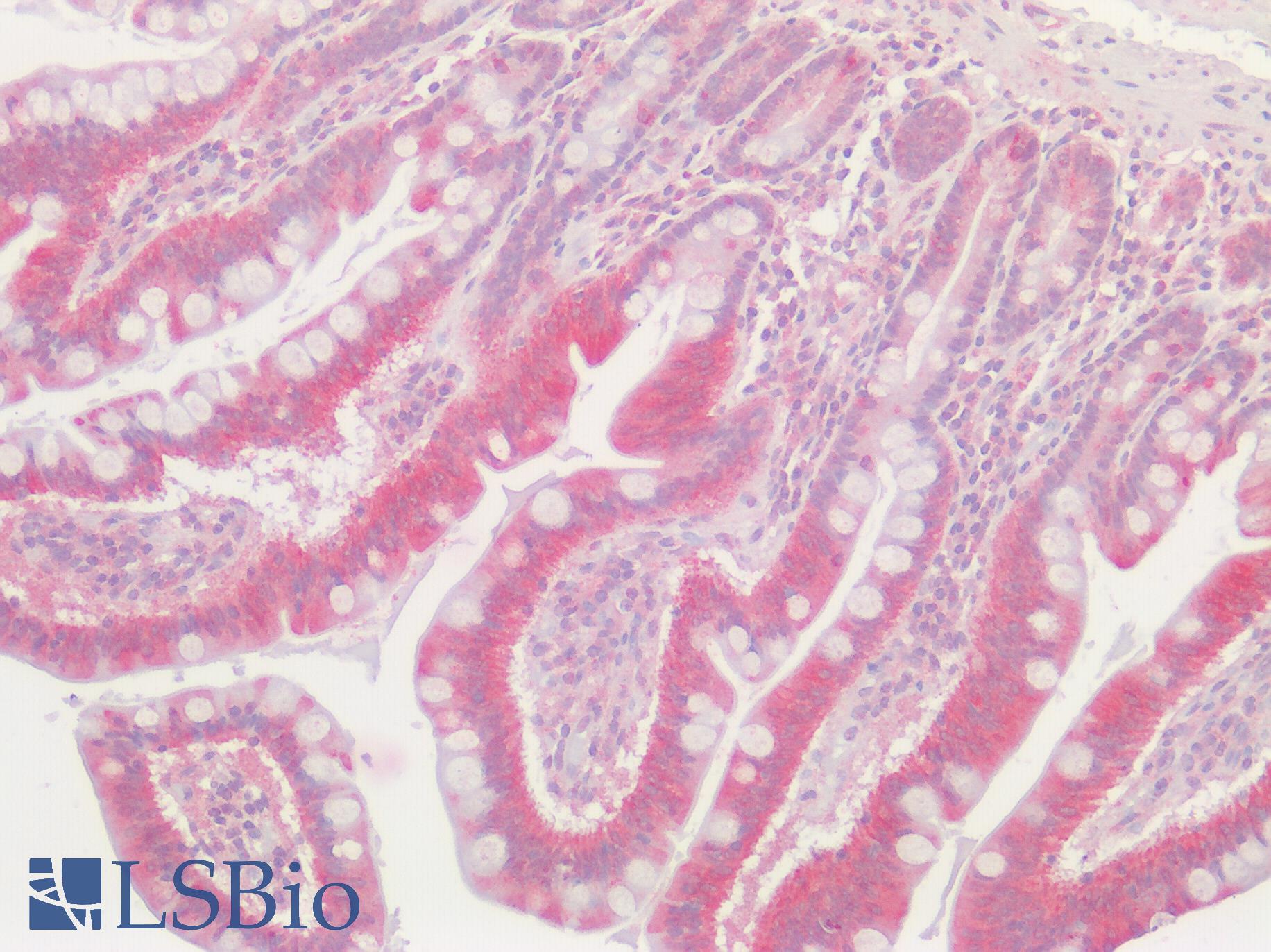 GPRC5D Antibody - Human Small Intestine: Formalin-Fixed, Paraffin-Embedded (FFPE)