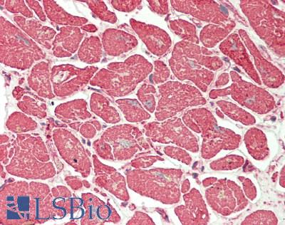 Actin Antibody - Human Heart: Formalin-Fixed, Paraffin-Embedded (FFPE)