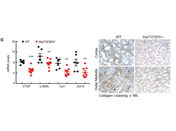 Immunohistochemistry using Collagen Type I