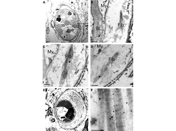 IEM using Collagen Type I