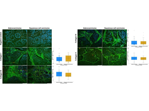 Immunofluorescence using Collagen Type I