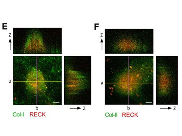 Immunofluorescence using Collagen Type I