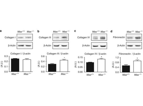 Western Blot using Collagen Type I